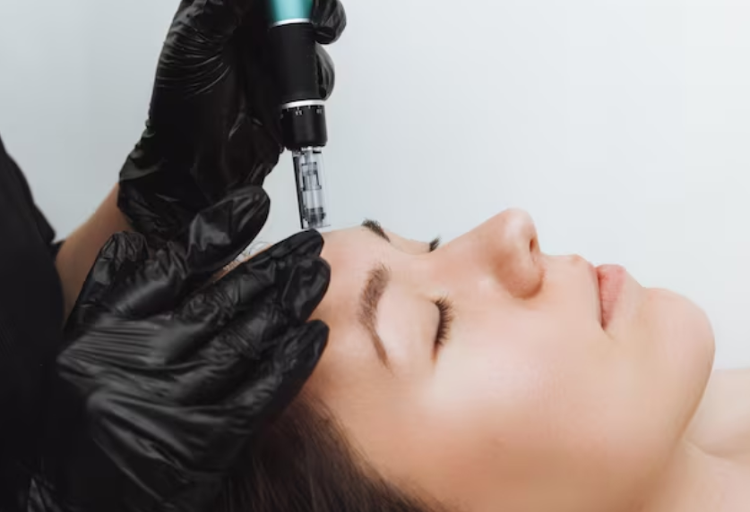 Sync Your Skin Best Week of Your Cycle for Microneedling Treatment (2)