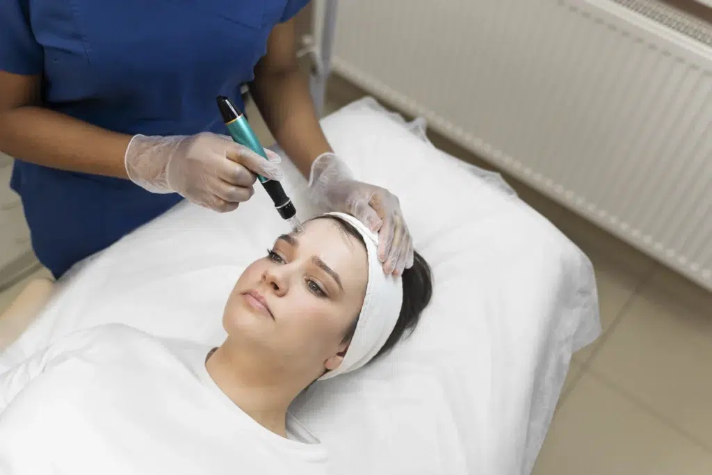 A lady with headband having a session for Microneedling treatment in siesta key fl