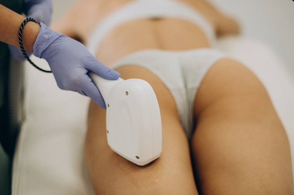 a woman lying down enjoying laser hair removal clinic in palmetto fl