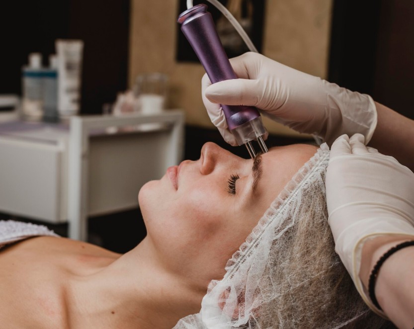 a woman with closed eyes having a microneedling in palmetto fl