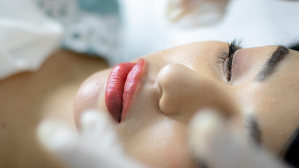 a woman with eyes closed having microneedling in siesta key fl