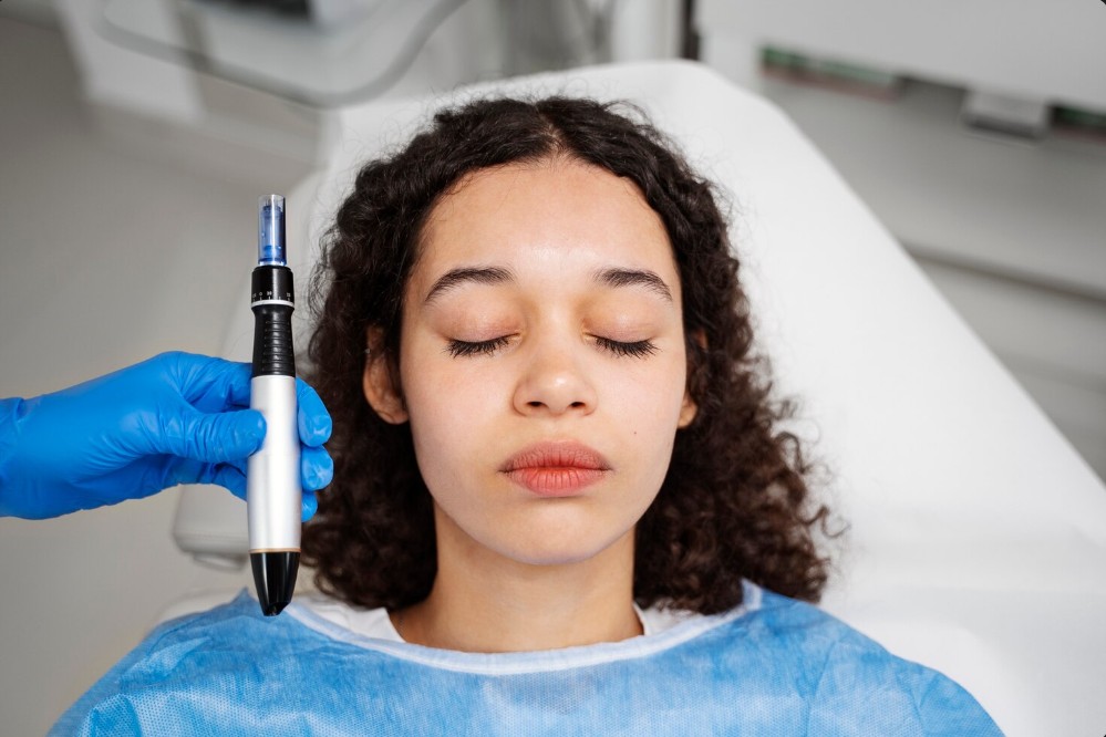 curly haired woman having a microneedling in parrish fl