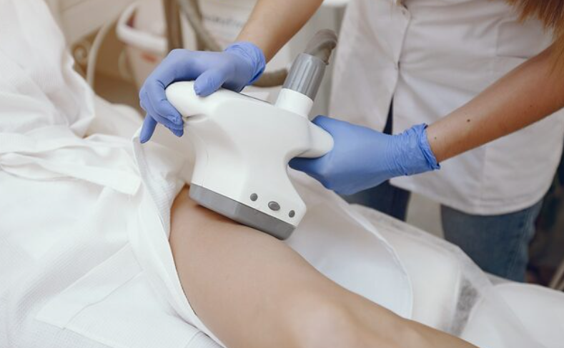 Laser Hair Removal Sarasota (2)