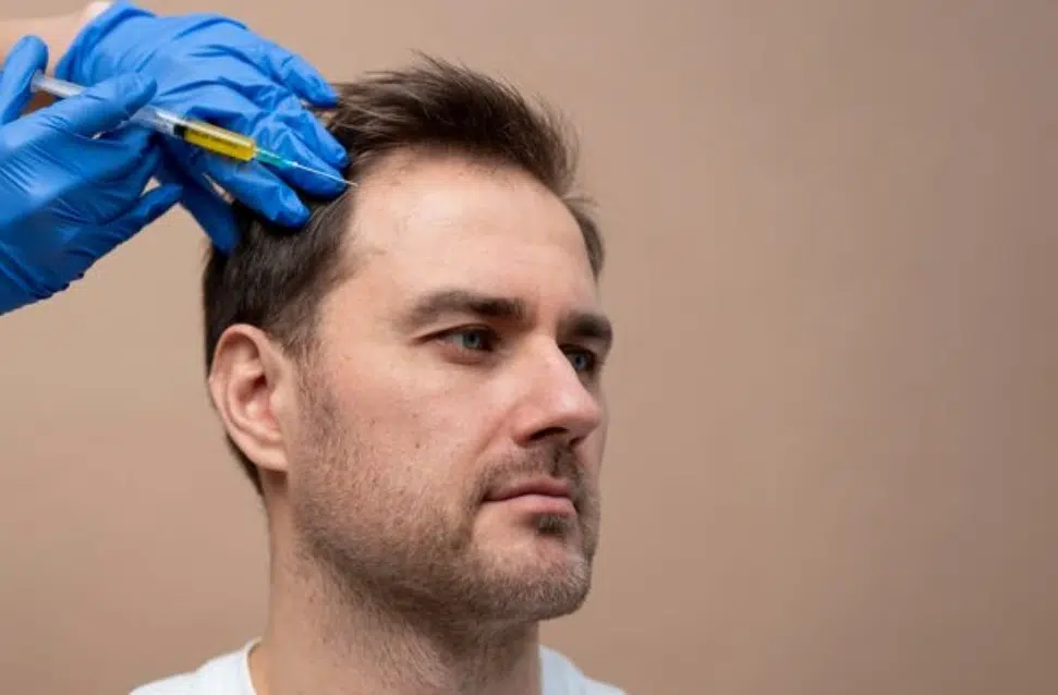 What Is PRP Hair Restoration