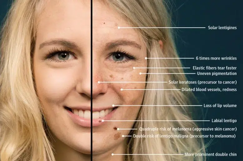 Age Spots vs Sun Damage: How to Tell the Difference