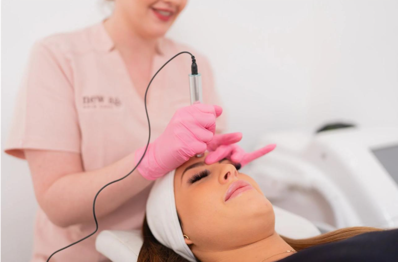 Microneedling for Collagen Production How the Process Works